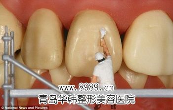 超聲波潔牙多少錢