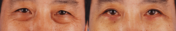 nʽ۴׌۾W(xu)(hu)“fe”