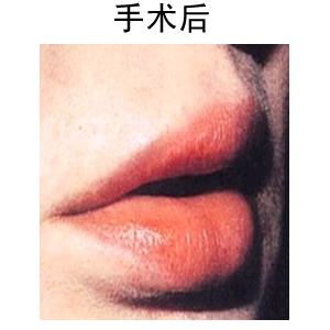 青島的豐唇醫(yī)院