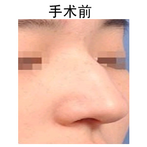 ʺǰ(du)Ƭ