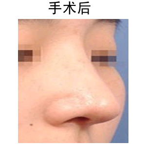 ʺǰ(du)Ƭ