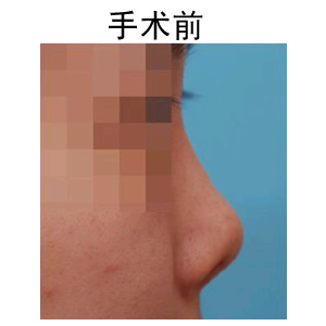 uע¡ҪX