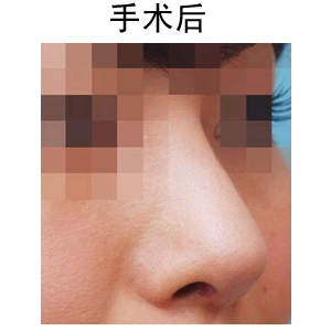 uע¡ҪX