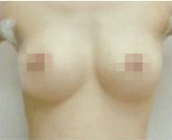 ¡ޏ(f)Ƭ