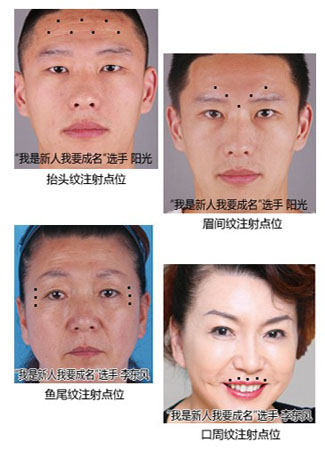沿y핿gČg