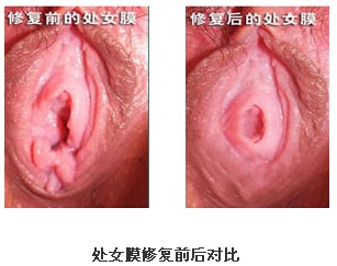 nʽ̎ŮĤޏ(f)