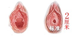 處女膜修復(fù)術(shù)時(shí)間
