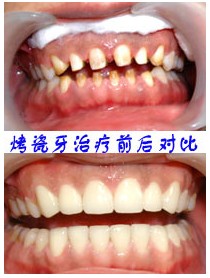 Щ(x)TӰ푿|(zh)