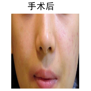 ǰ(du)Ƭ
