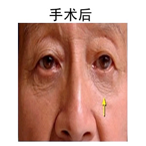 ۴ޏ(f)ǰ(du)Ƭ