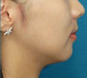 µ˄Q°ͣ