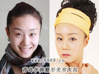 賈蓉漂唇美容效果前后對比圖