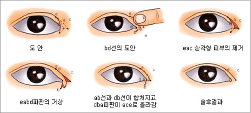 pƤбҪ_۽ǆ