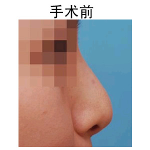 ע¡ǶX(qin)
