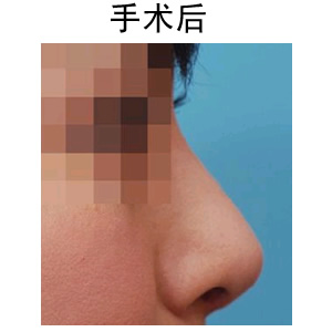 ע¡ǶX(qin)