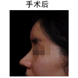 uע¡ǃr(ji)