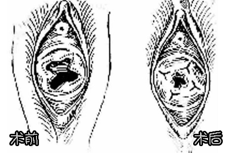 ̎ŮĤޏ(f)Ƭ