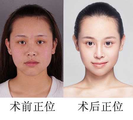 沿tѪzЧǰ󌦱ȈD