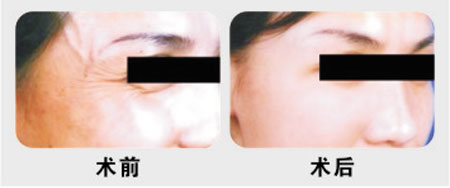 Щ(yu)c