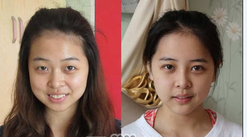 陳瑛改臉型前后對比照片