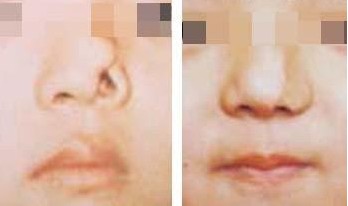 ȱpޏ(f)
