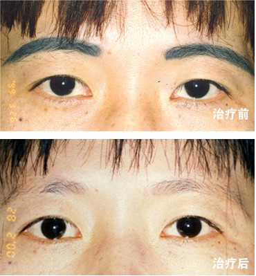uϴyüX(qin)