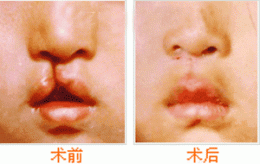 ȱpޏ(f)ǰ(du)Ƭ