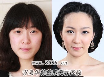 注射隆鼻后多久能化妝