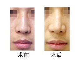 uע¡ЧSֶ