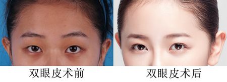 pƤЧǰ(du)ȈD