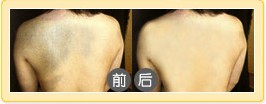 Чǰ󌦱ȈD