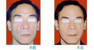 沿ǰ(du)ȈD