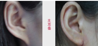 Sǰ(du)