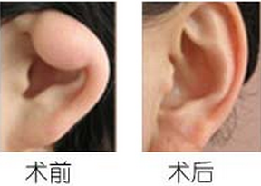 Cǰ󌦱