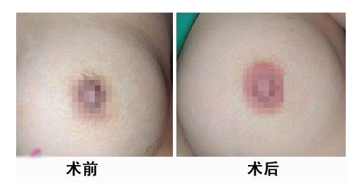 镞Ưtǰ(du)ȈD