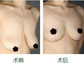 鷿´Cǰ(du)ȈD