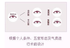 nʽز}