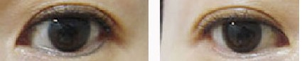 ϴ۾