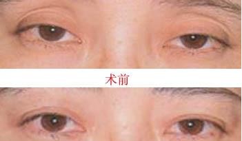 ۲ίЧǰ󌦱ȈD
