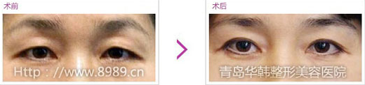 Cϲ´ǰ(du)