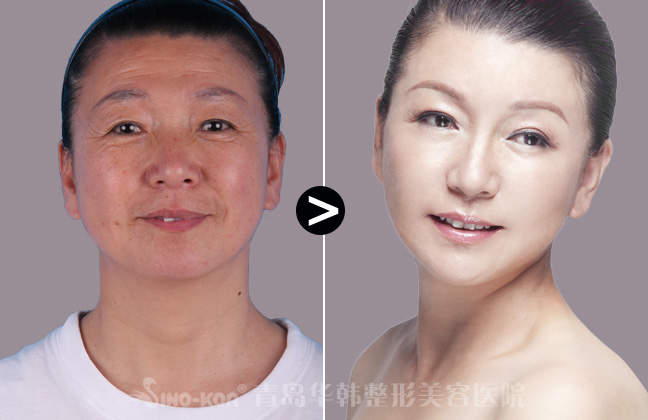 沿Ƥǰ(du)ȈD
