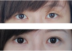_(ki)۽ǰЧ(du)