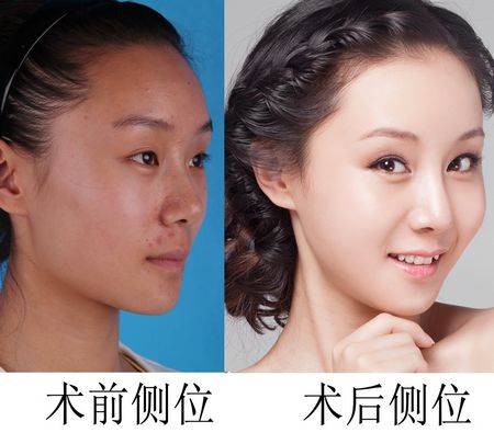 沿ЧȈD