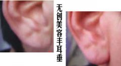 Чǰ󌦱