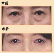 Чǰ(du)