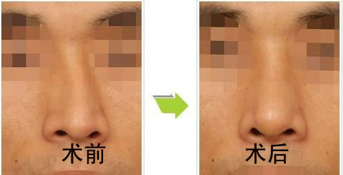 ǳCg(sh)ǰ(du)