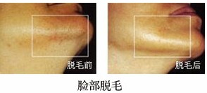 沿ÓëЧǰ(du)ȈD