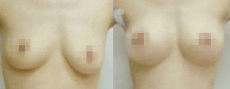 w¡ʧޏ(f)ǰ(du)