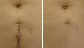̺ޏ(f)Ч(du)