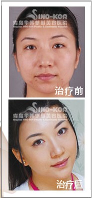 沿ÓëЧ